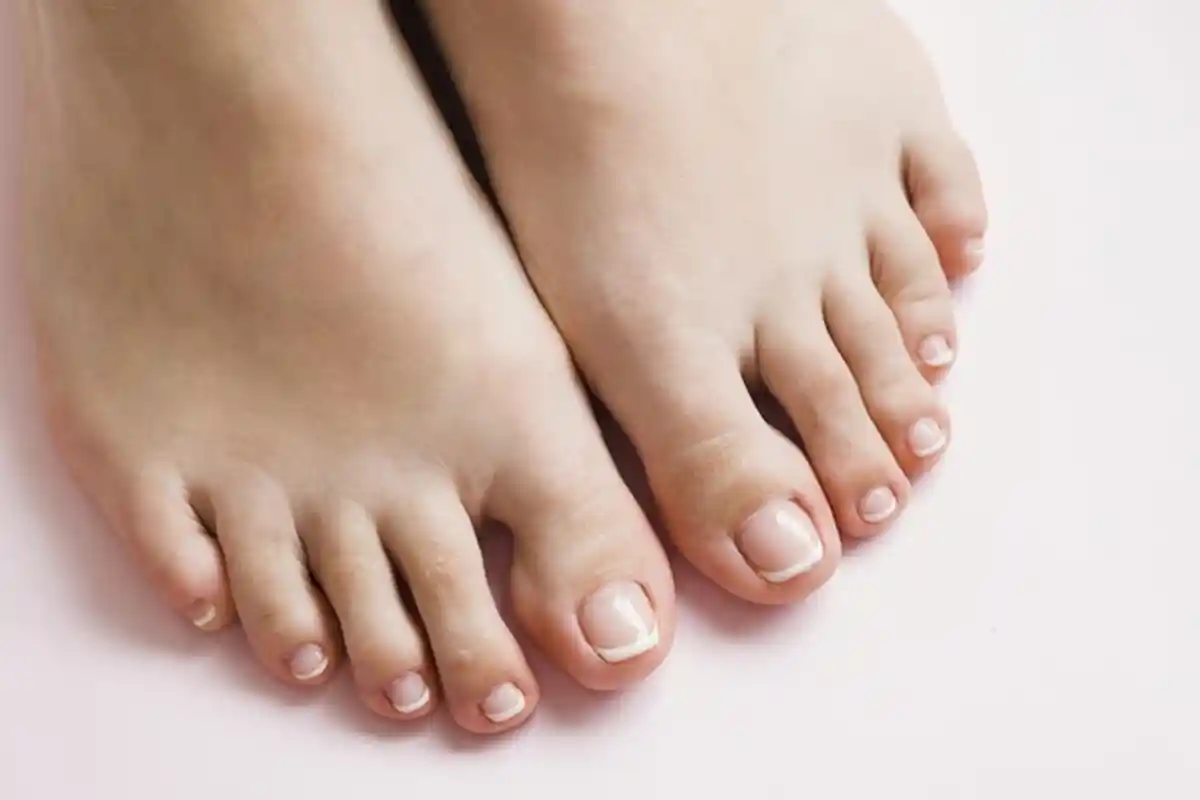 Telapak Kakimu Kerap Sakit saat Bangun Tidur? Ini Sederet Penyebabnya