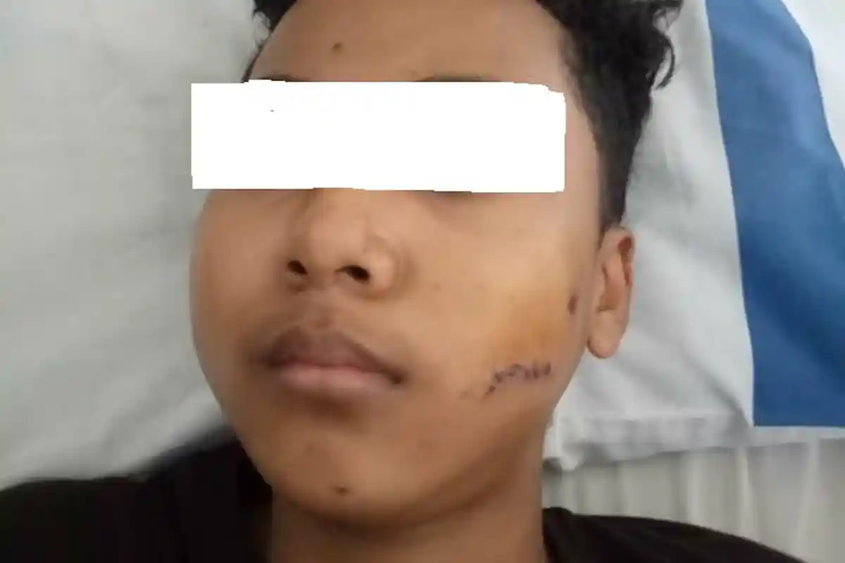 Terkena Letusan Proyektil Peluru, Santri Ponpes di Pemayung Dilarikan ke RS