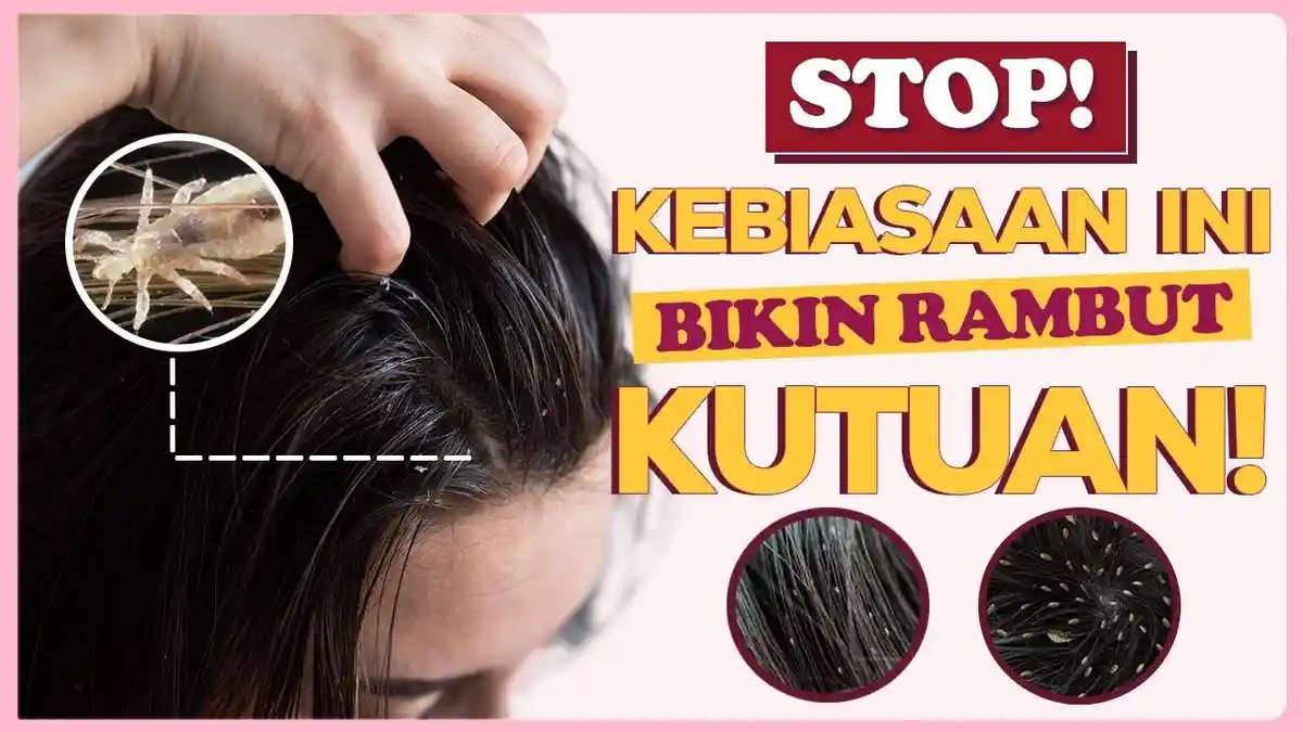 5 Cara Mudah dan Ampuh Mengatasi Rambut yang Sudah Menjadi Sarang Kutu, Secara Alami