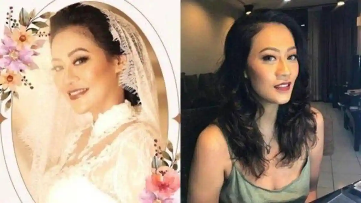 Polisi Periksa 3 Dokter Terlibat Dalam Operasi Sedot Lemak Nanie Darham Berujung Meninggal Dunia