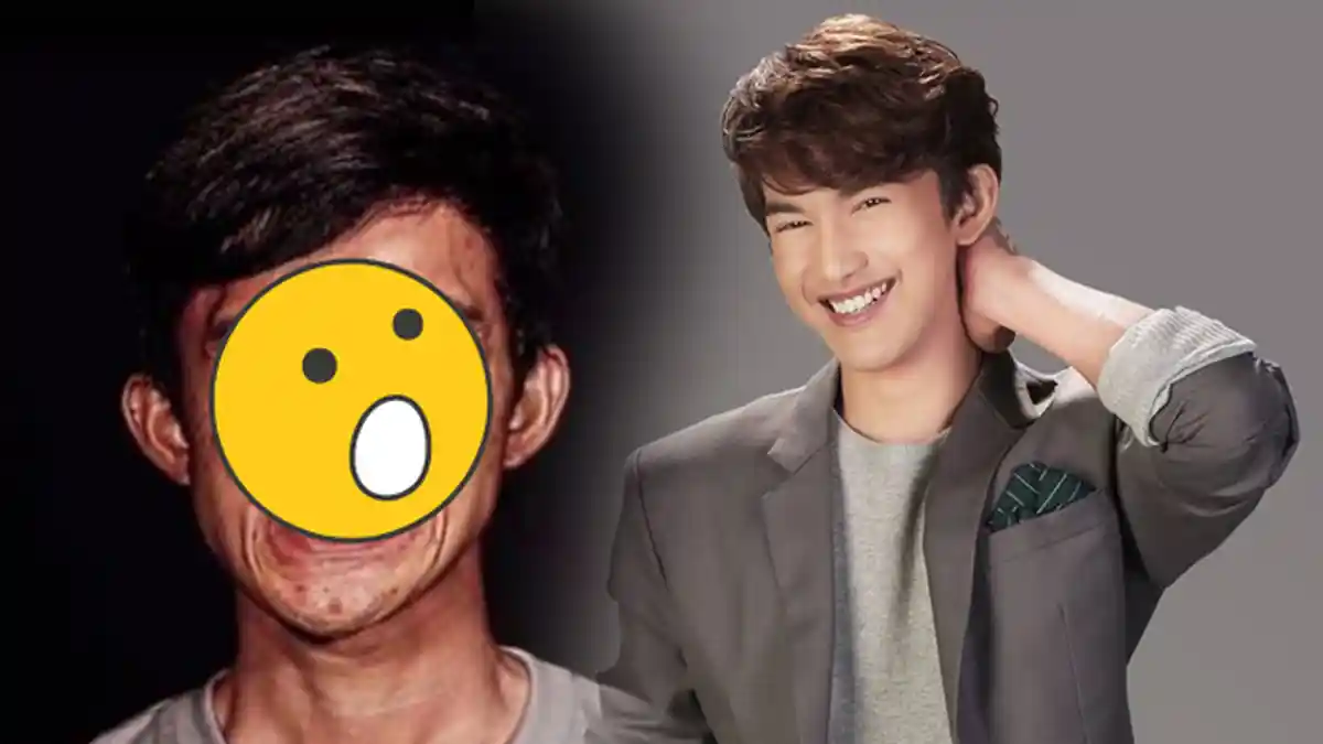 Mantap! Berubah Tampan Bak Oppa Korea, Pria Ini Tetap Setia Pada Kekasihnya yang Transgender
