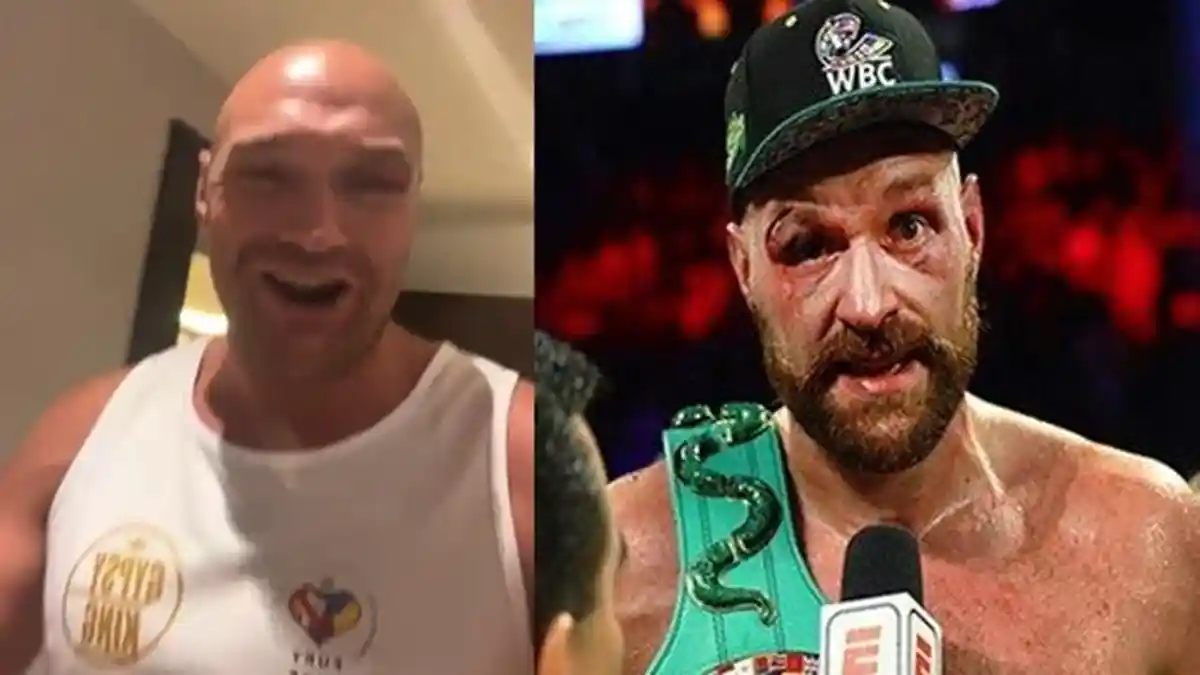 Tyson Fury Terima 11 Jahitan, Tinju Dunia Hadapi Oleksandr Usyk Batal?