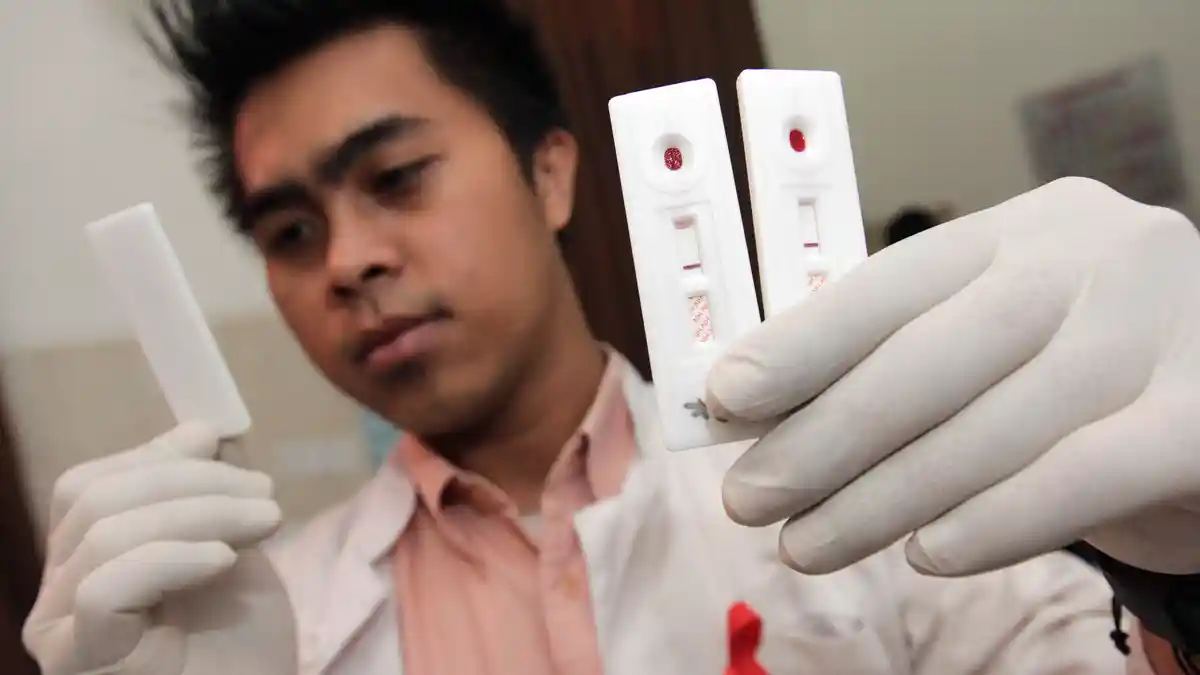 Gama Sarankan Calon Pengantin Tes HIV