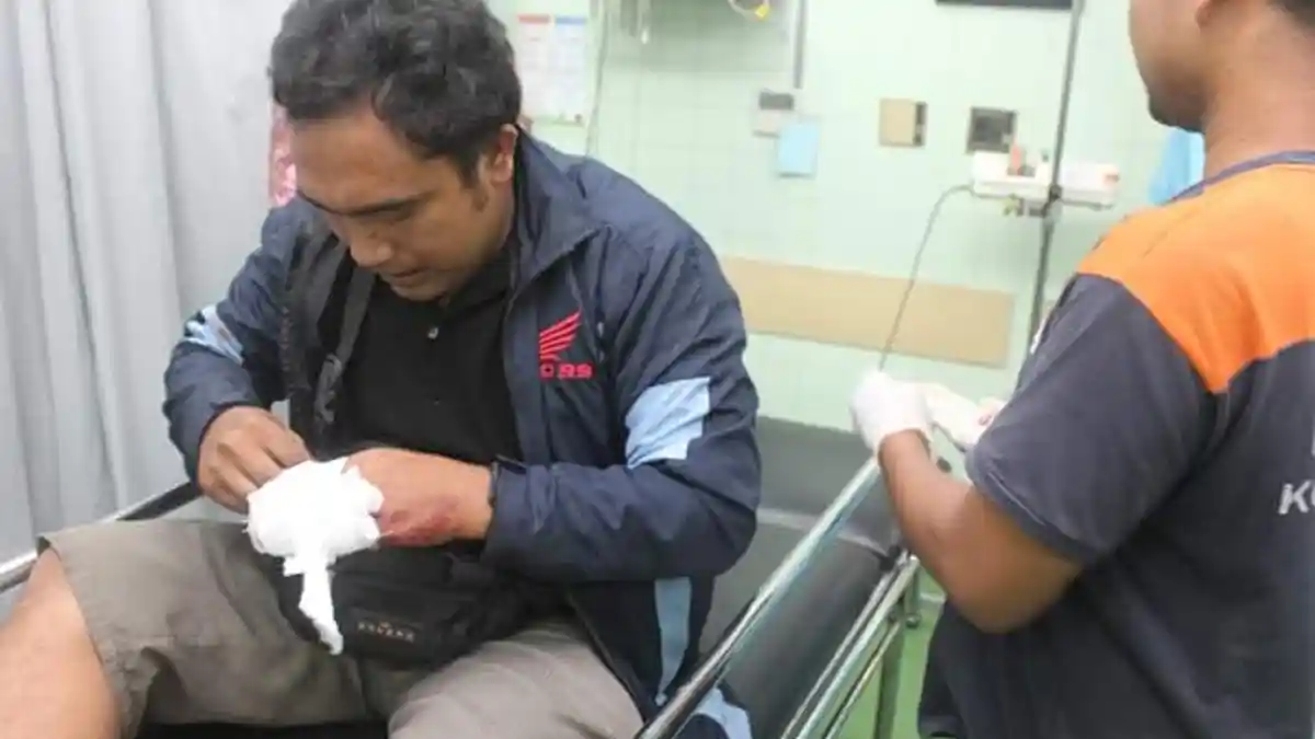 Jari Komang Adi Diamputasi, Kecelakaan Tunggal Merasa Seperti Ada yang Dorong