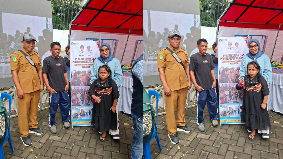 Dua Warga Disabilitas asal Taliabu Terima Bantuan Kaki Palsu dari Dinsos Malut