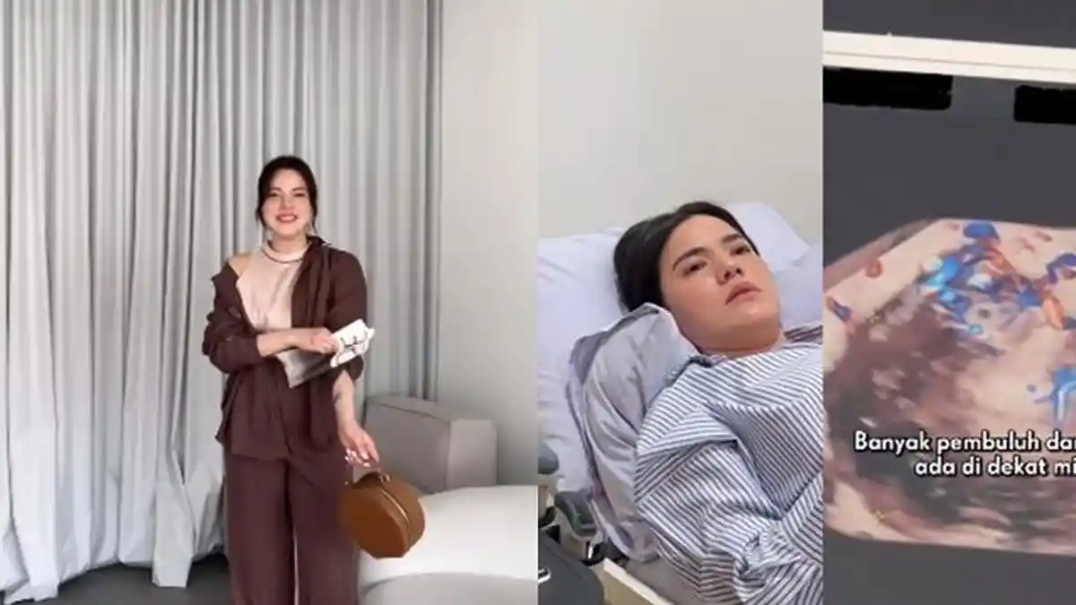 Pengakuan Pilu Artis Alice Norin, Curhat Tak Bisa Lagi Punya Anak, Divonis Idap Kanker Sarkoma Rahim