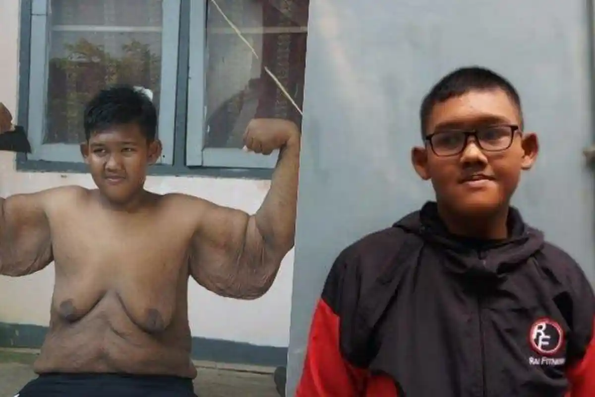 7 Fakta Arya Permana Turunkan Berat Badan 109 Kg, Dibantu Ade Rai hingga Ditangani 13 Dokter