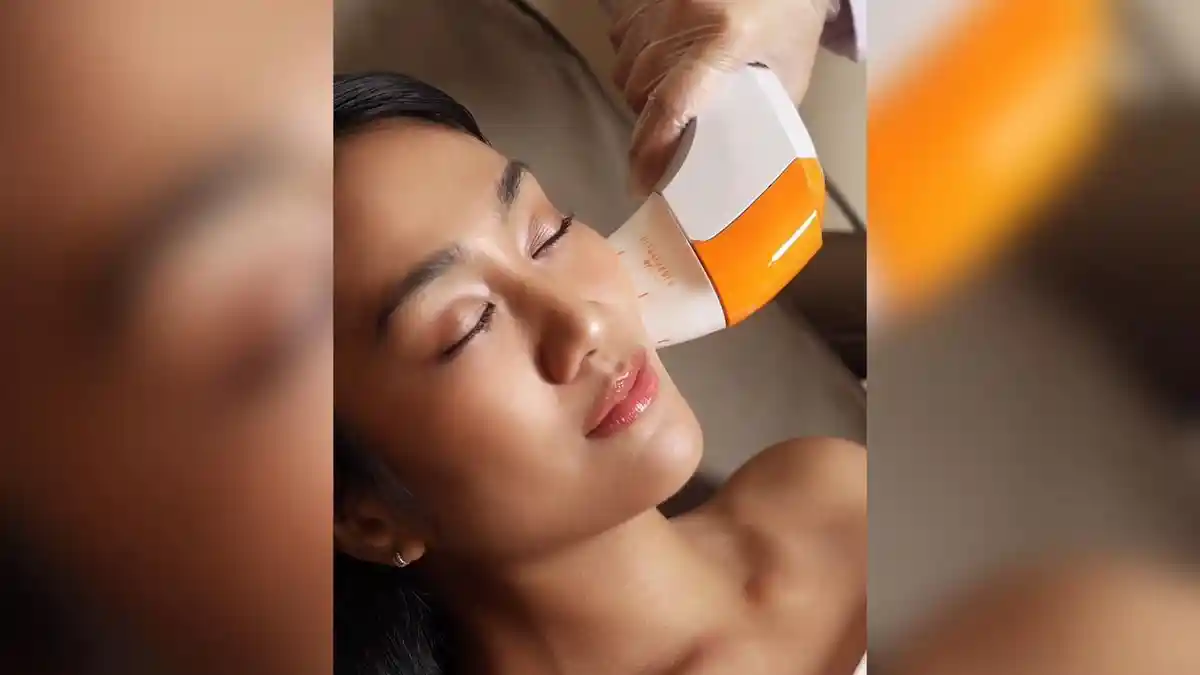 Ultraformer MPT, Solusi Anti Aging Tanpa Rasa Sakit, dr. Eliza Kodrat: Mampu Jangkau Area Sempit
