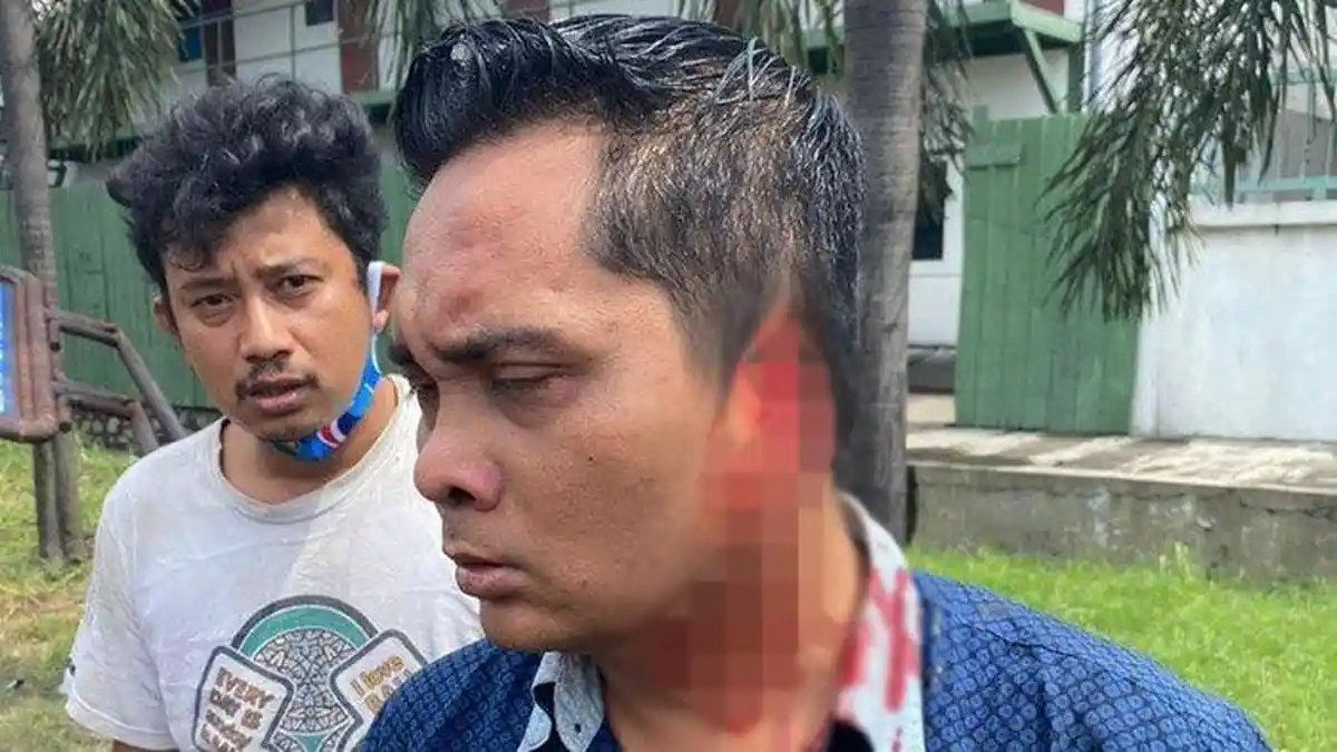 Geram Tak Bisa Nyalib Bus, Pengendara Motor Nekat Gigit Telinga Kondektur Bus Sampai Putus