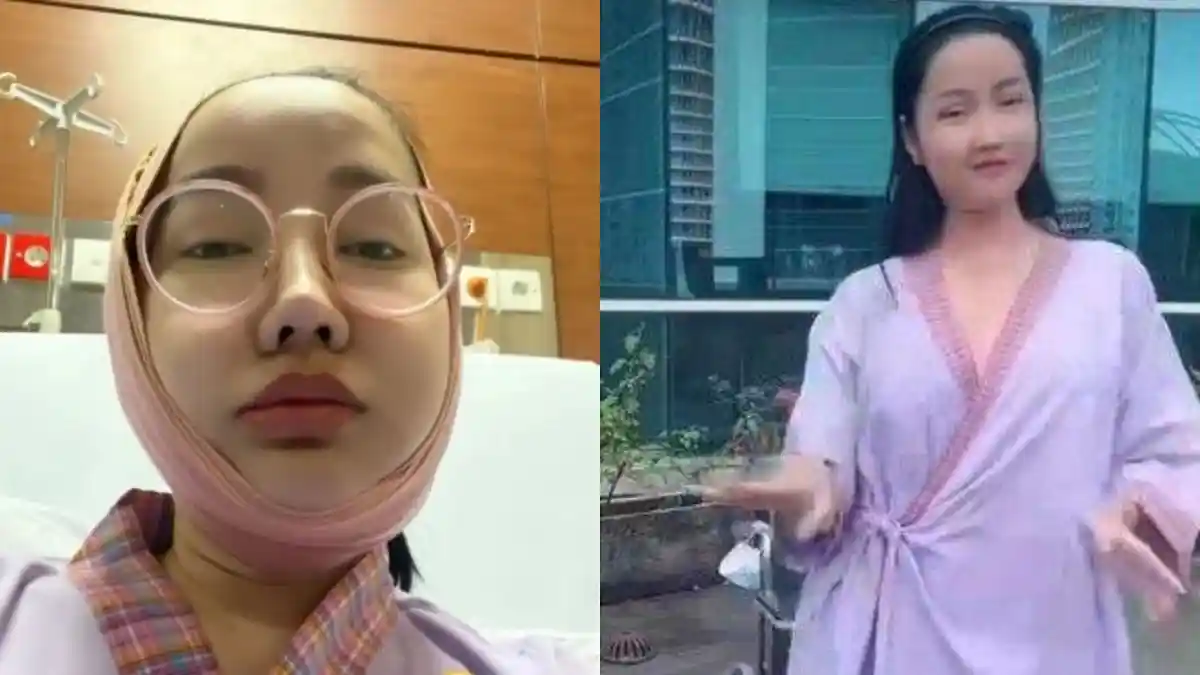 Kabar Terbaru Lucinta Luna Setelah Alami Infeksi Gusi hingga Batal Nonton Konser Blackpink