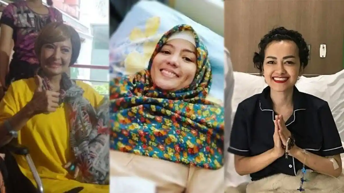 Perjuangan 3 Artis Cantik Melawan Kanker