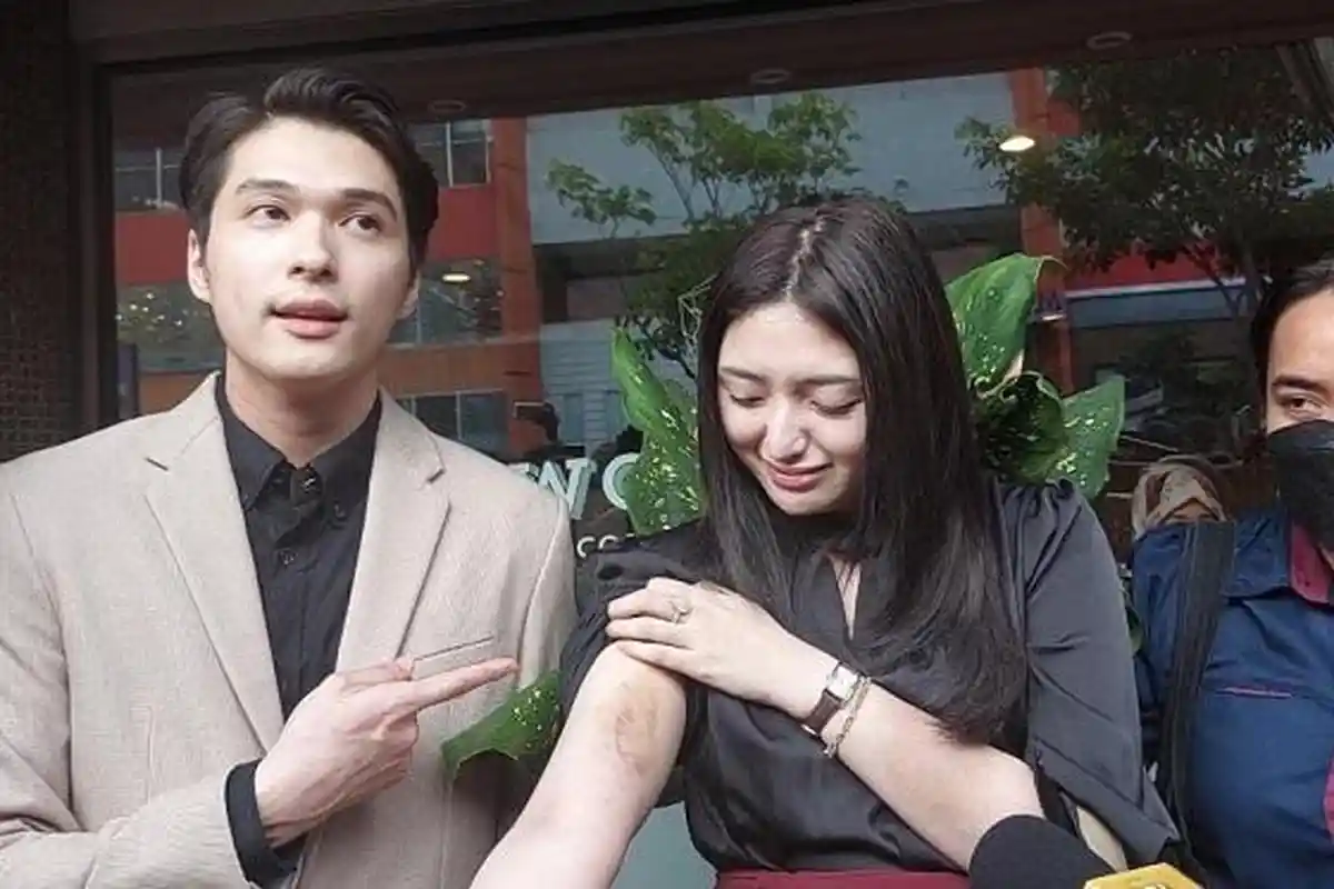 Dihajar Pria Gemulai saat Dugem, Aspri Hotman Paris Intan Nallendra: Dia Lecehkan Pacar Saya