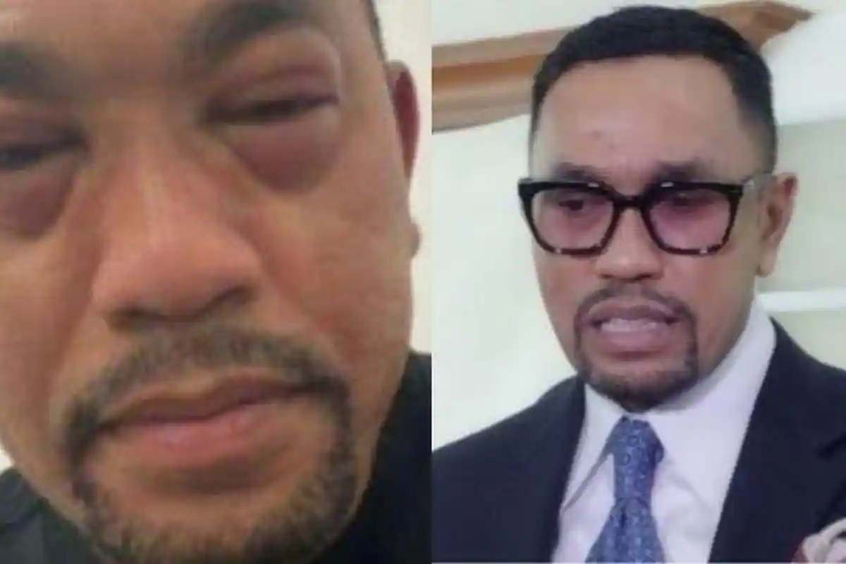 Tanggapan Ahmad Sahroni Usai Dinyatakan Resmi Langgar Kode Etik, Pasrah Ditimpa Masalah Bertubi-tubi