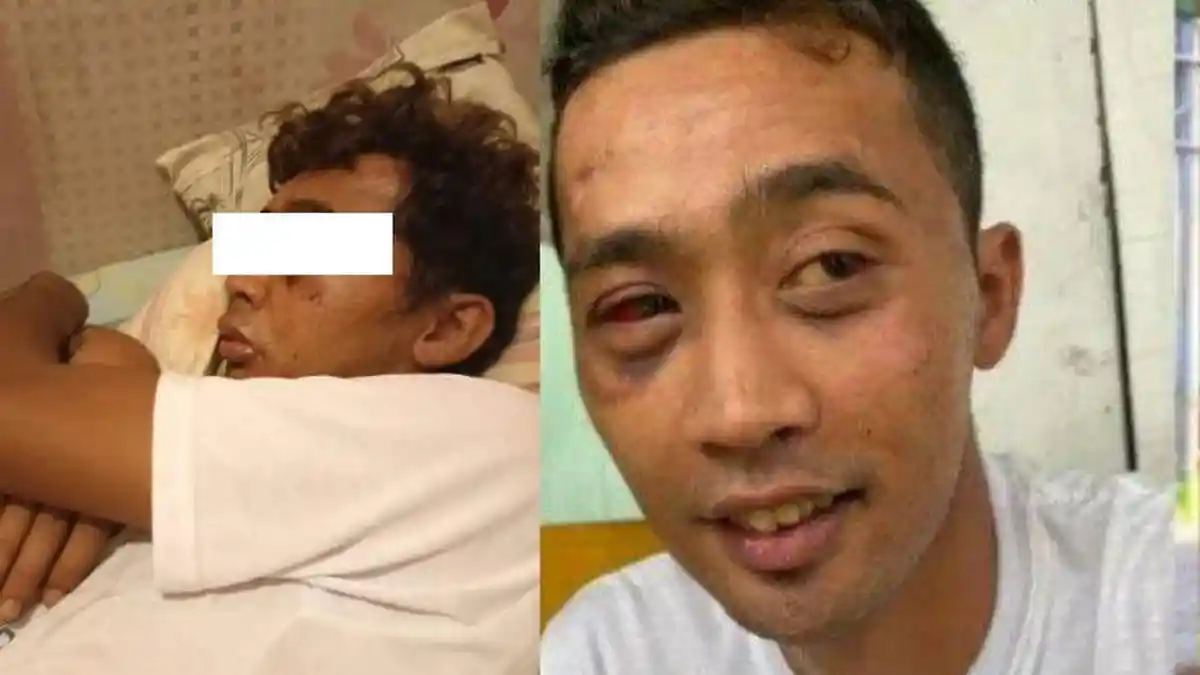 Kisah Pengamen keterbelakangan Mental Dipukul hingga Babak Belur, Uang untuk Bantu Ibu Dirampas