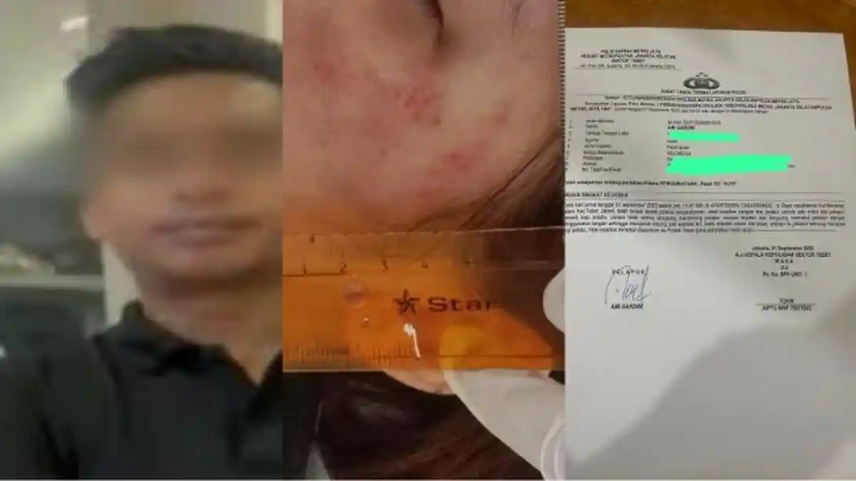 Anggota DPRD Diduga Aniaya Kekasihnya di Apartemen, Pelaku Kesal karena Korban Menagih Utang