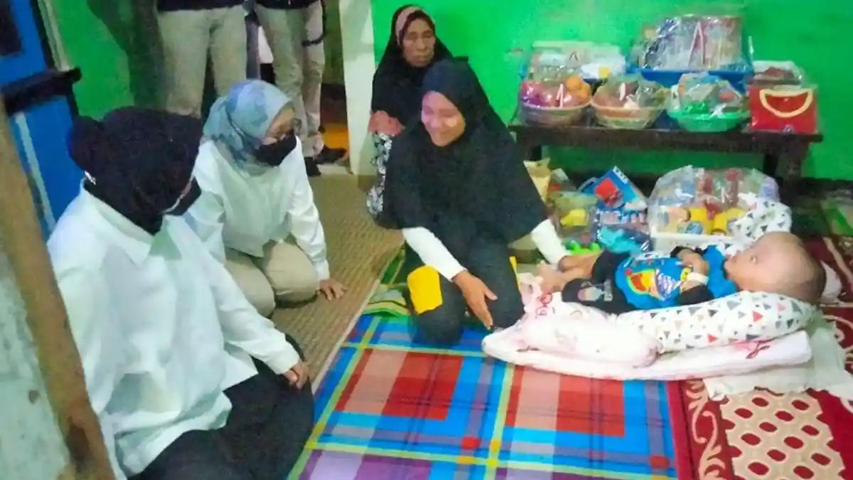 Jenguk Bocah Penderita Hidrosefalus di Cigudeg Bogor, Tri Rismaharini Minta Dokter RSCM Maksimal