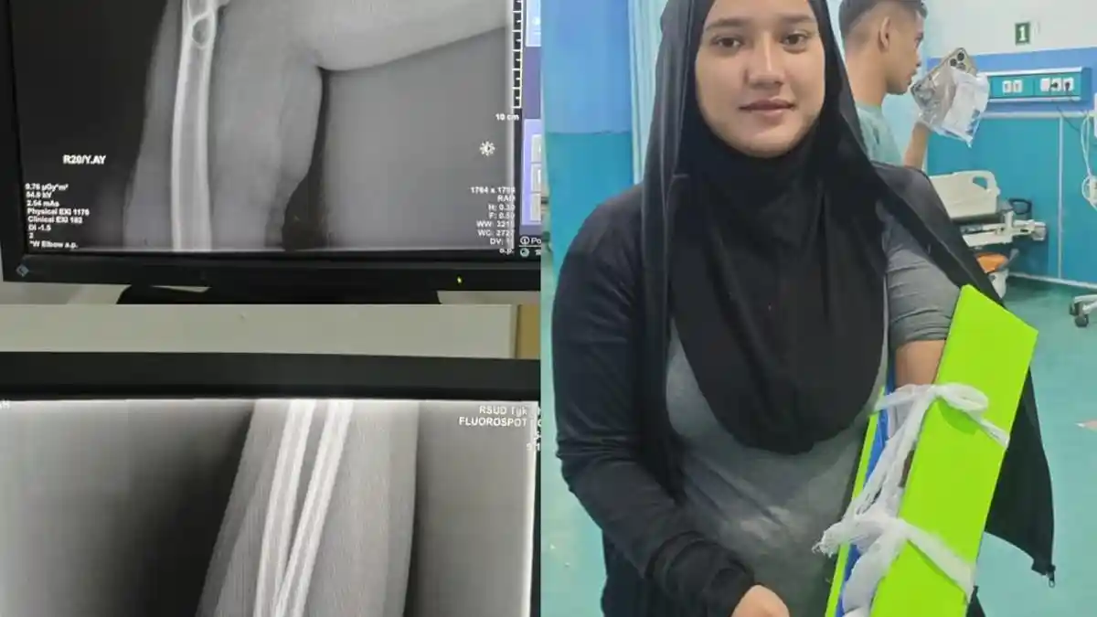 Dua Atlet Taekwondo Aceh Timur Cedera Saat Berlaga dalam Prapora di Pidie