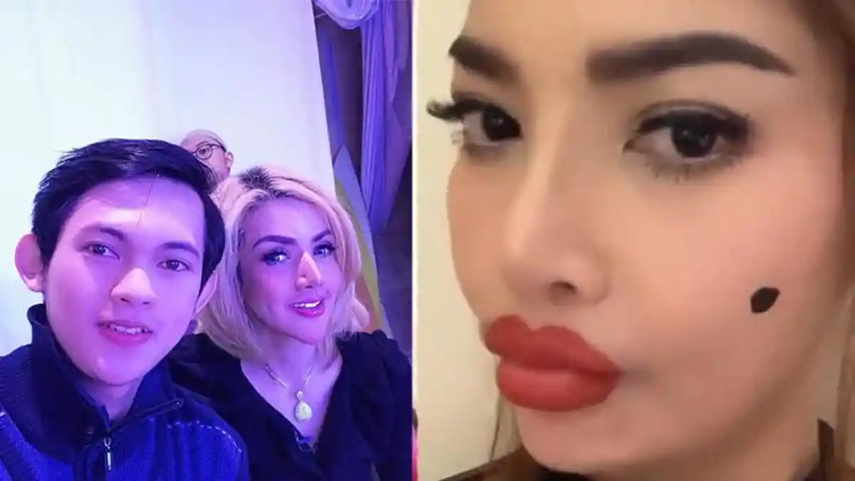 Temani Barbie Kumalasari Sulam Bibir, Irfan Sebastian Disindir Irma Darmawangsa, Cemburu?