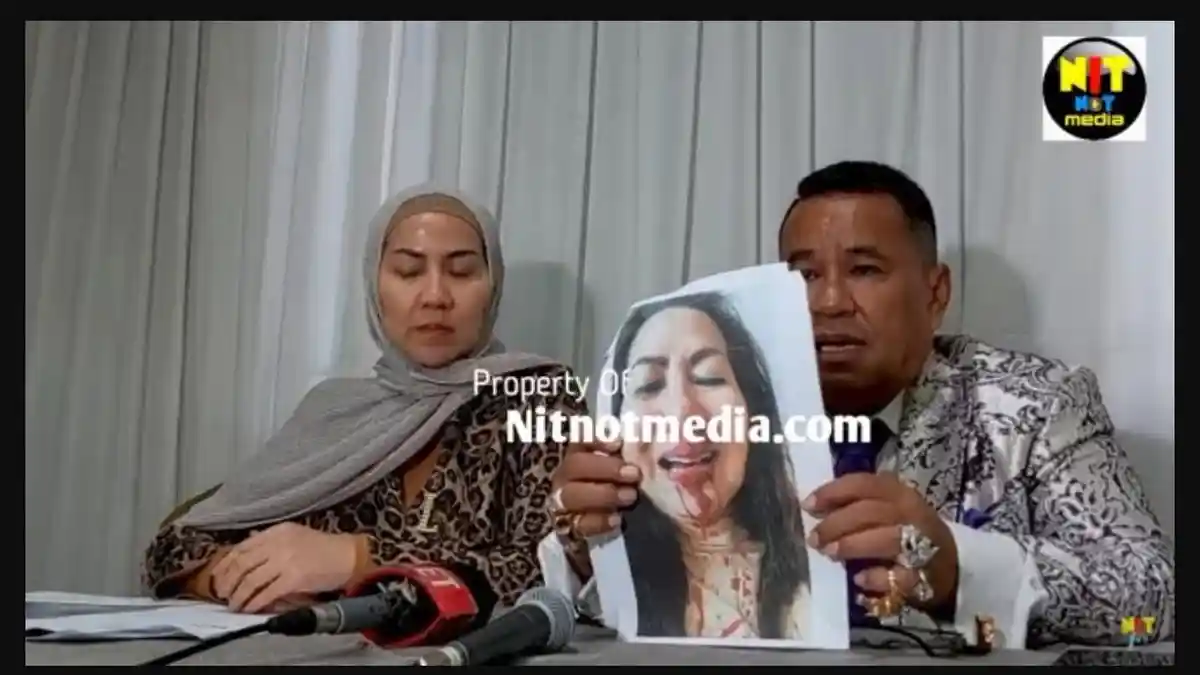 Reaksi Hotman Paris Saat Venna Melinda Difitnah Pukuli Diri Sendiri hingga Berdarah