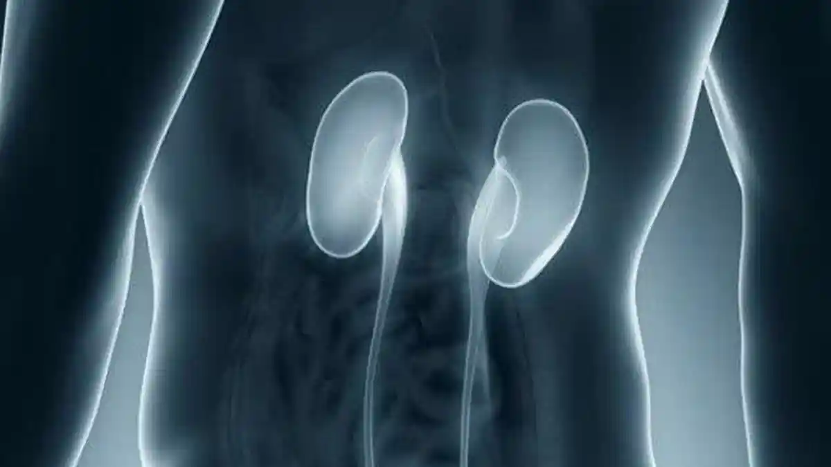 INFO SEHAT - 7 Makanan dan Minuman ini Baik untuk Menjaga Kesehatan Ginjalmu