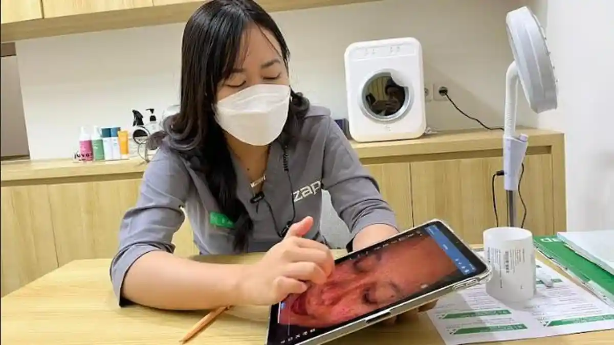 Mengenal Permasalahan Kulit Wajah Melasma, Dari Penyebab Hingga Cara Mengatasinya