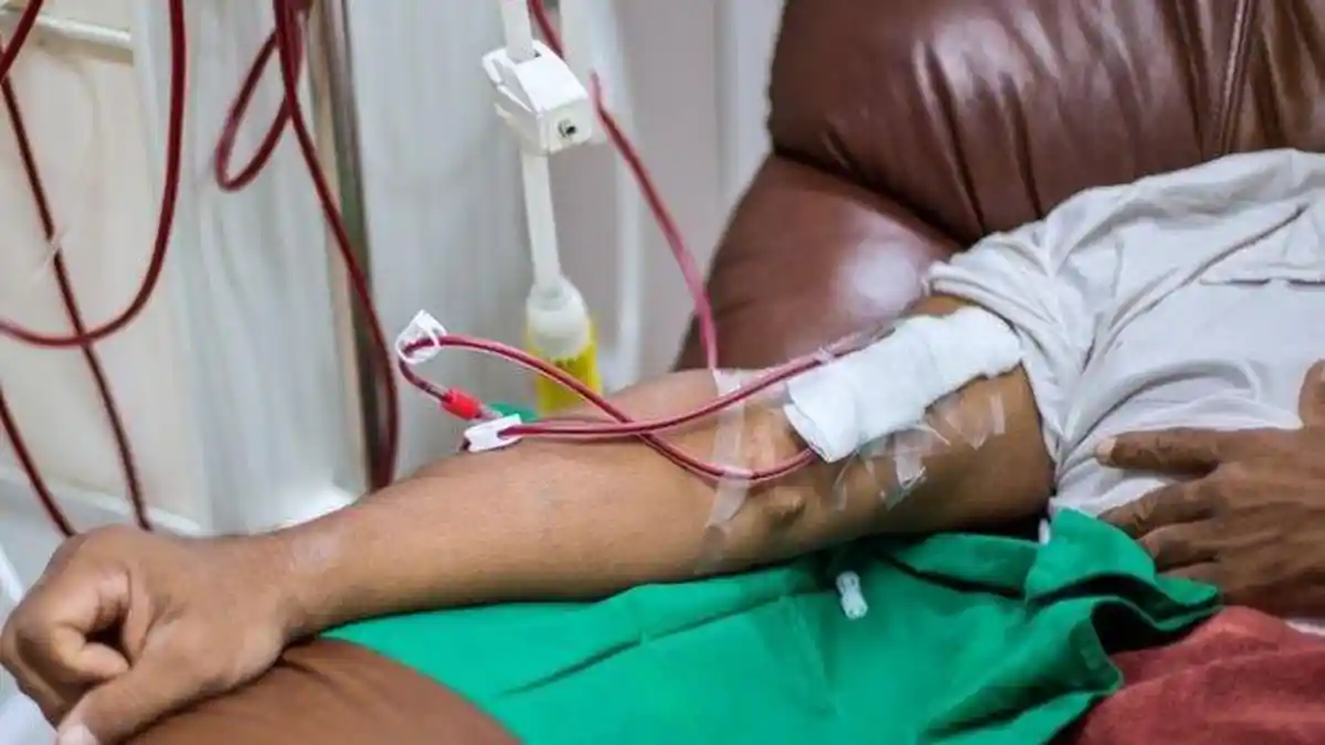 Apa Itu Hemodialisa? Terapi Cuci Darah untuk Pasien Gagal Ginjal, Ini Cara Kerjanya