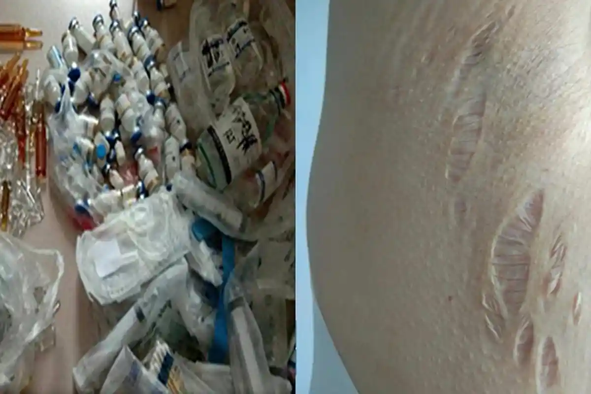 PILU Mantan Istri Dokter, Dituduh Selingkuh hingga Diracuni Sampai Cacat: Dia Menghancurkan Hidupku