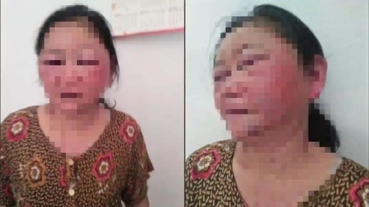 Jadi Tulang Punggung Keluarga, Wanita Ini Babak Belur Dihajar Suami yang Bawa Pulang Selingkuhan!