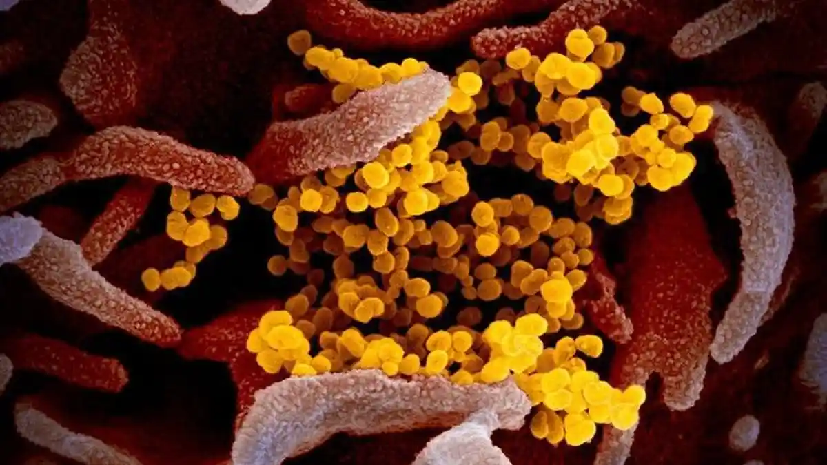 Hingga Hari Ini 78.998 Orang terinfeksi Virus Corona, 2.470 Meninggal Dunia, 23.448 Sembuh