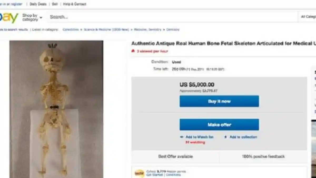 Toko Online eBay Menawarkan Organ Tubuh Manusia