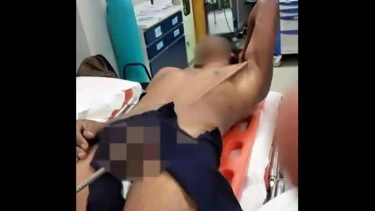 Pekerja Ini Tertancap Sepotong Besi dari Alat Vital Tembus di Ketiak