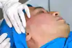 Pipi Pengen Kencang, Treatment Tarik Benang APTOS di Dermaster