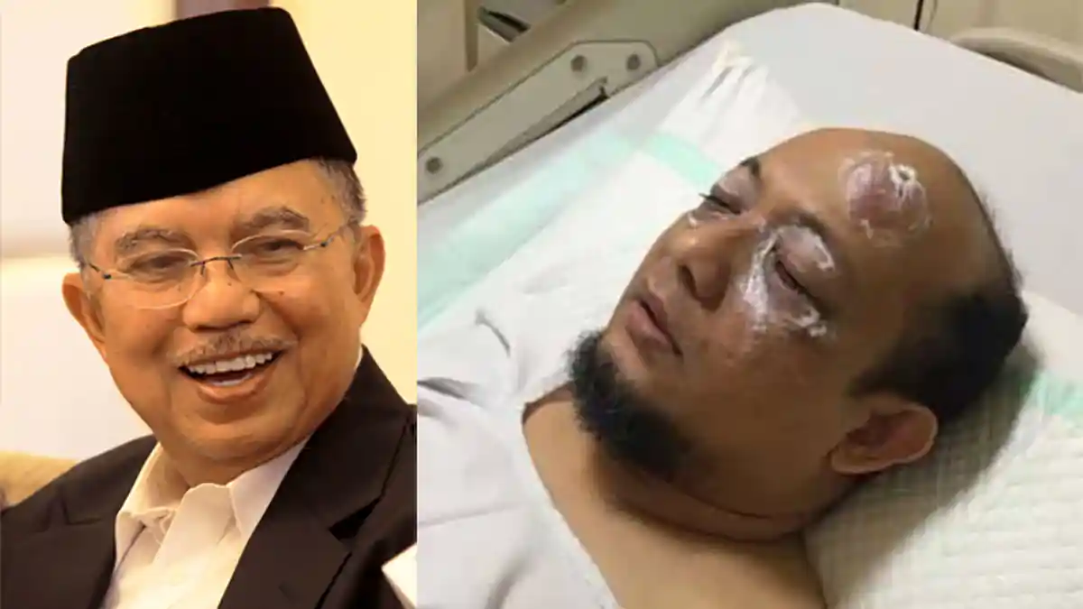 Alasan Pimpinan KPK Minta Jusuf Kalla Bantu Biaya Pengobatan Novel Baswedan