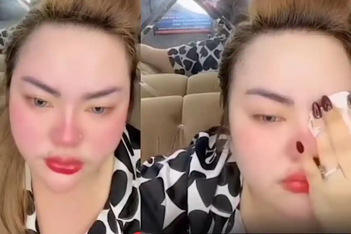 Lisa Mariana Jatuh Sakit Setelah Jadi Tersangka Kasus Pencemaran Nama Baik Ridwan Kamil