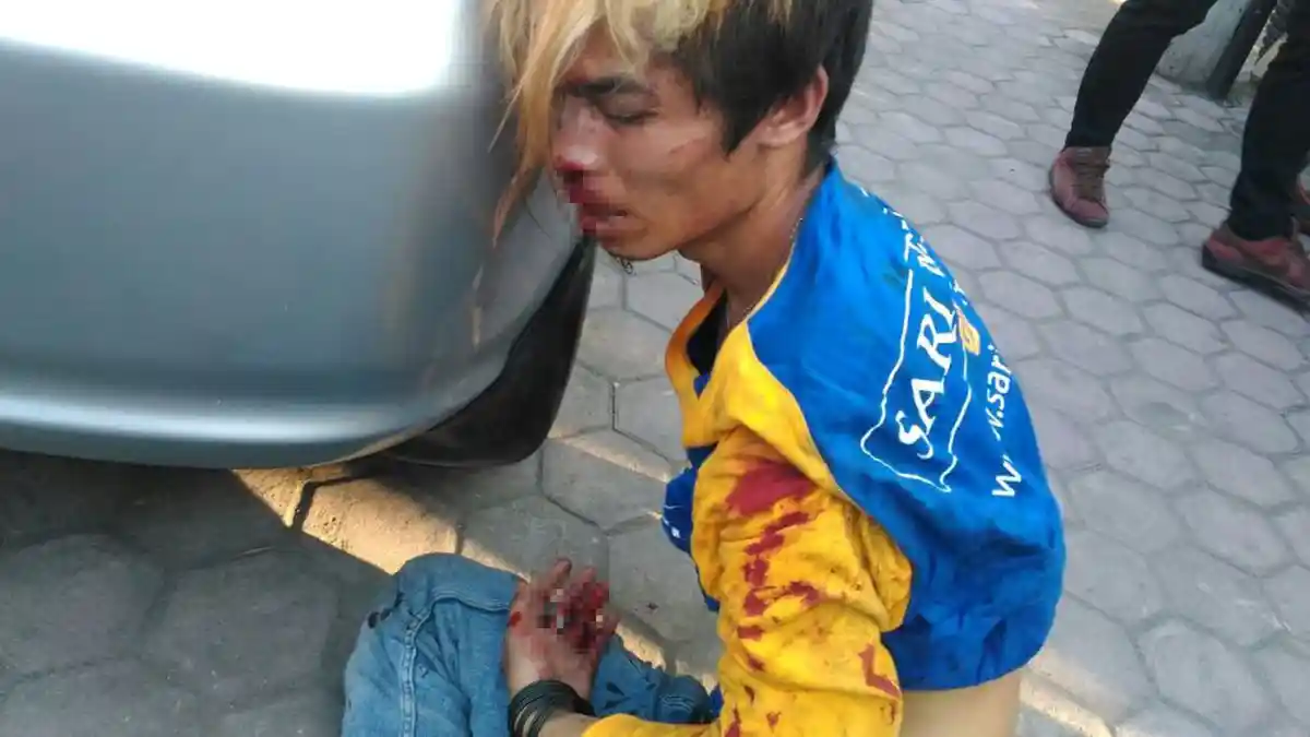 Pelaku Jambret Sempat Diteriaki Akan Dibakar Hidup-hidup