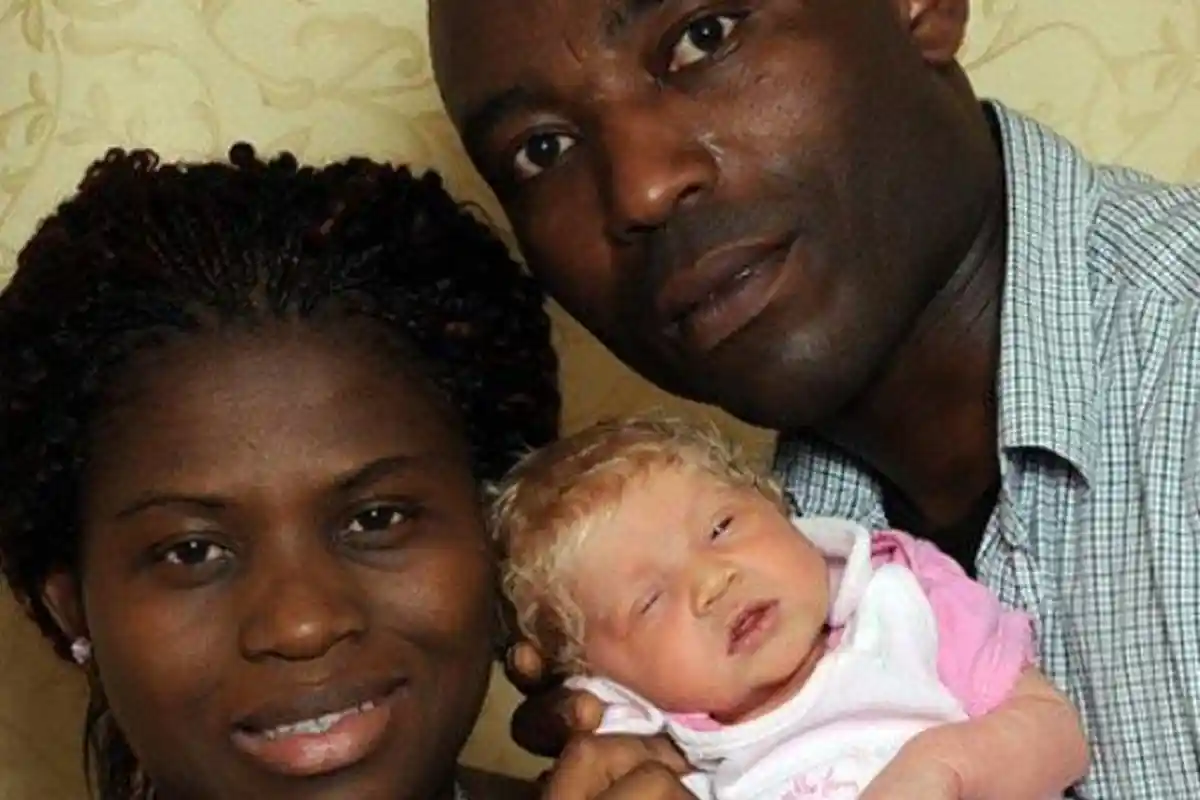 Pasutri Kulit Hitam Melahirkan Bayi Berkulit Putih, Suami Yakin Istri tak Selingkuh, Kini Terungkap