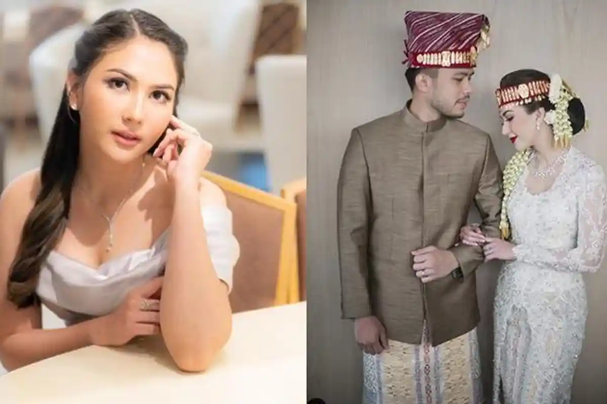 Jessica Mila Dicurigai Hamil Anak Pertama, Yakup Hasibuan: Doain Aja