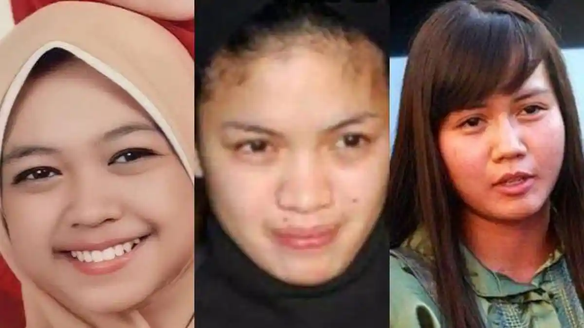 9 Transformasi Wajah Artis yang Mengejutkan, Ria Ricis hingga Nikita Mirzani, Ada yang Oplas!