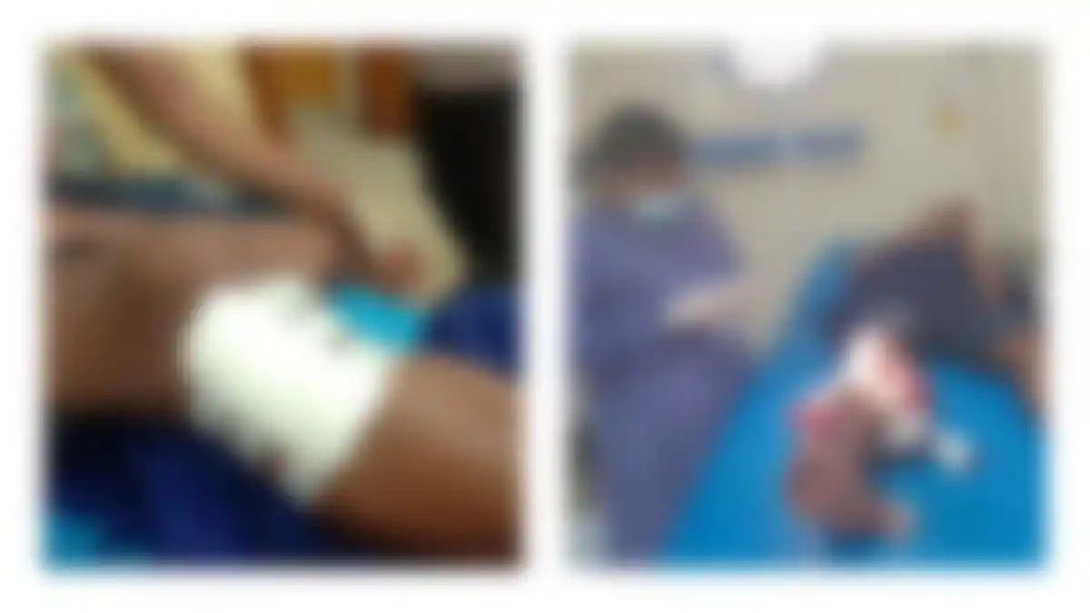 Seorang Pria Terkena Busur Panah saat Melintas di Depan Kampus UHO Kendari Subuh Dini Hari