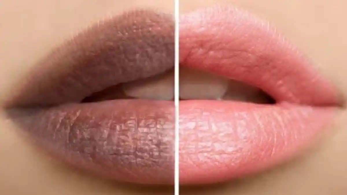 Bisa karena Makanan, Ini Penyebab Bibir Menghitam dan Cara Mencerahkannya 