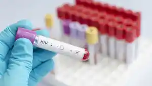 ilustrasi-hivaids_20161206_064516.jpg
