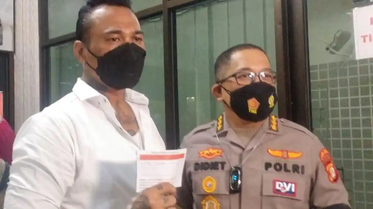 Sambangi Biddokkes Polda Metro Jaya, Jerinx Putuskan Terima Vaksinasi Covid-19