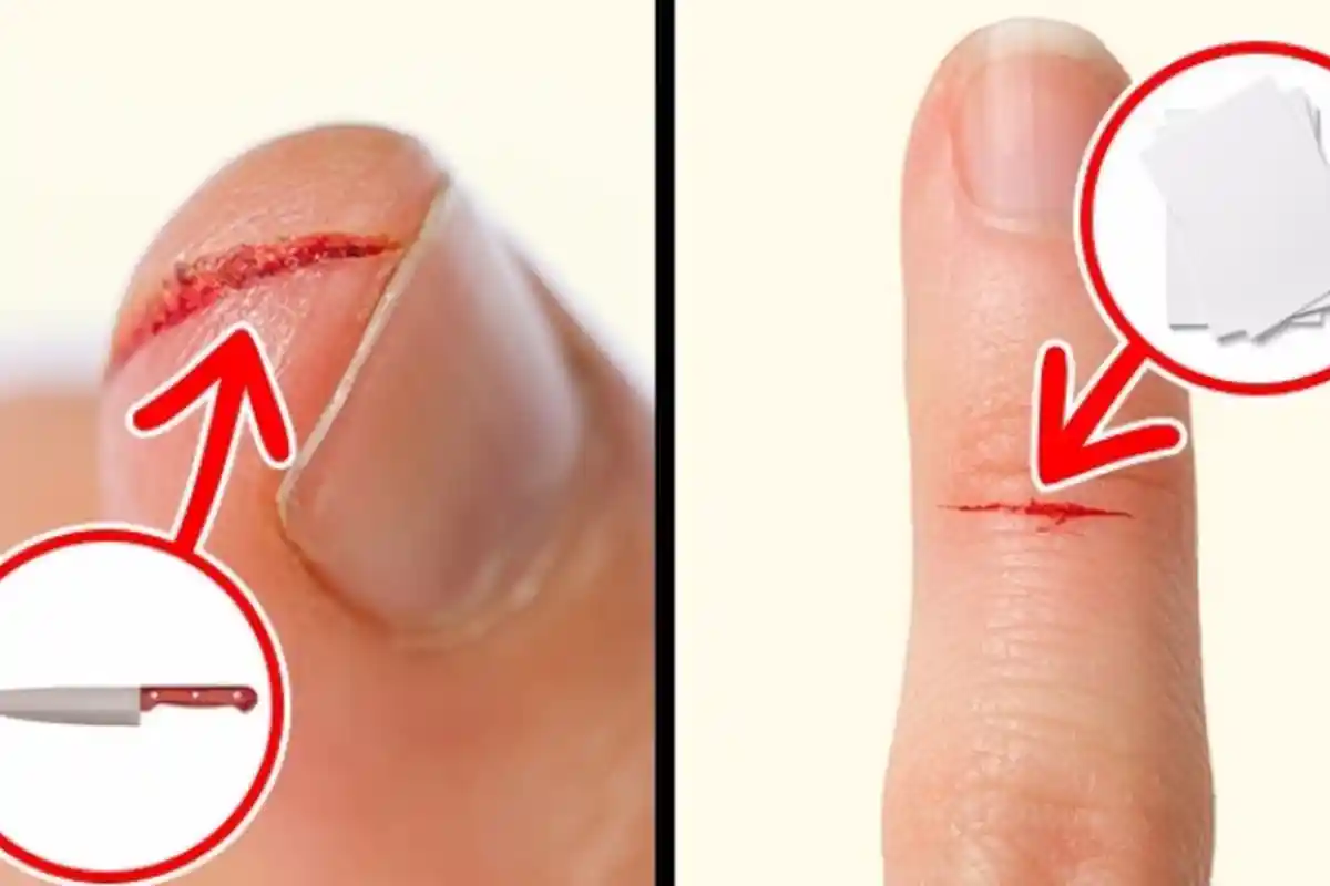 6 Fakta Konyol Tetapi Kenyataan Benar Terjadi, dari Susu hingga Bulu Dada Manusia!