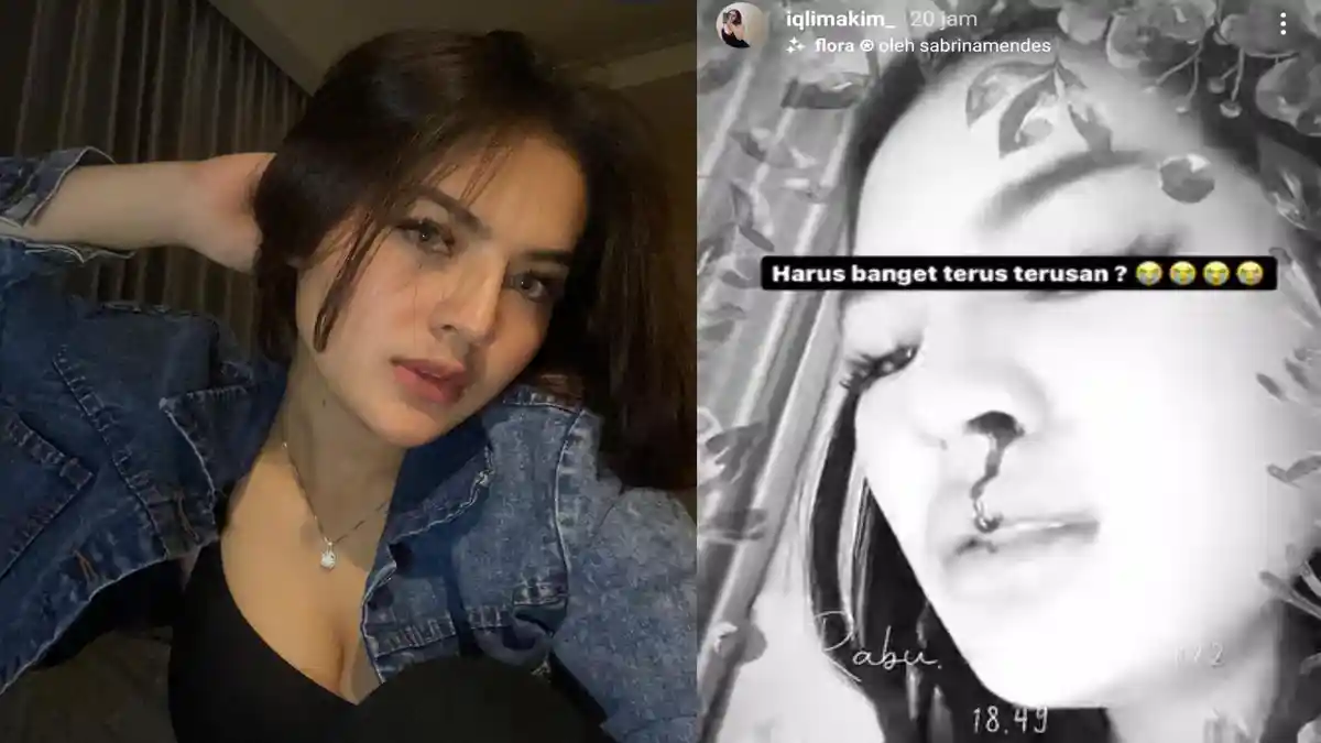 Ahli Medis Ragukan Pendarahan Hidung Iqlima Kim Gegara Ini, Hotman Paris Bereaksi