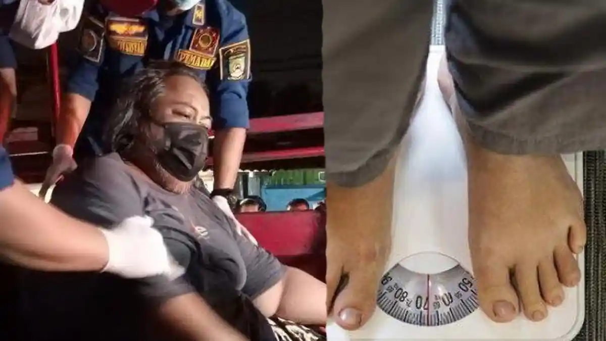 Pria di Tangerang Obesitas 200 Kg Sejak 8 Tahun Lalu, Celana Tak Ada yang Muat Akhirnya Pakai Sarung