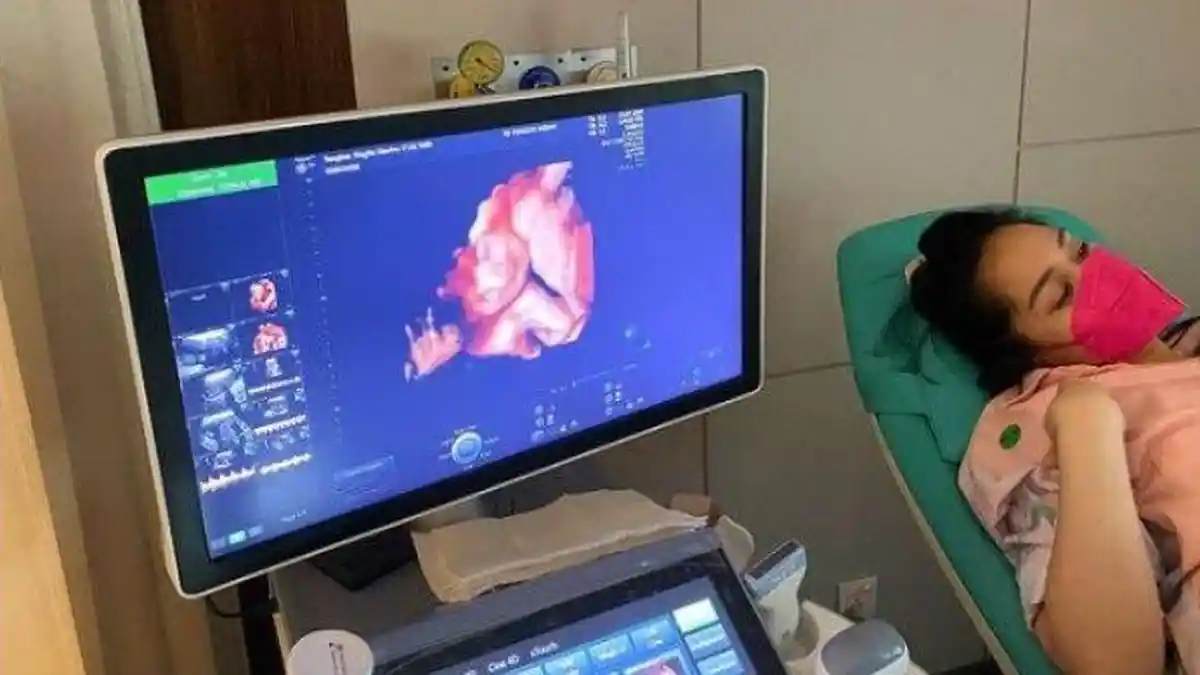 Raffi Ahmad Unggah Video Hasil USG Calon Anak Keduanya, Puji Hidung Bayinya yang Mancung