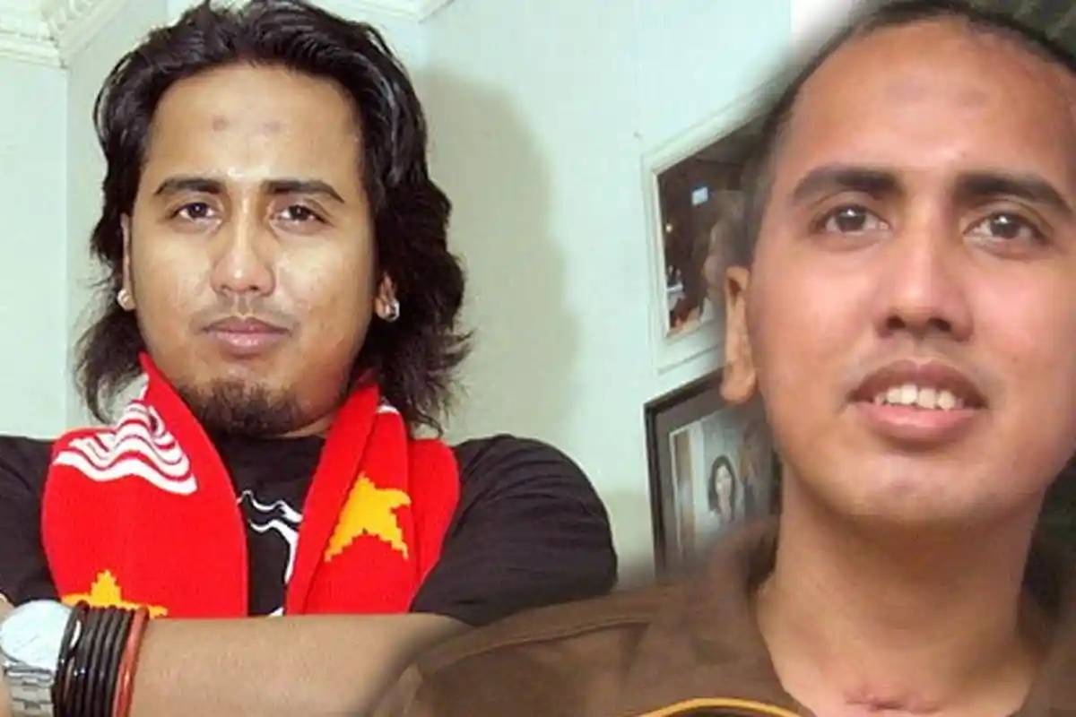 Apa Kabar Gugun Gondrong? 10 Tahun Lalu Menderita Tumor Otak, Begini Kondisinya Sekarang