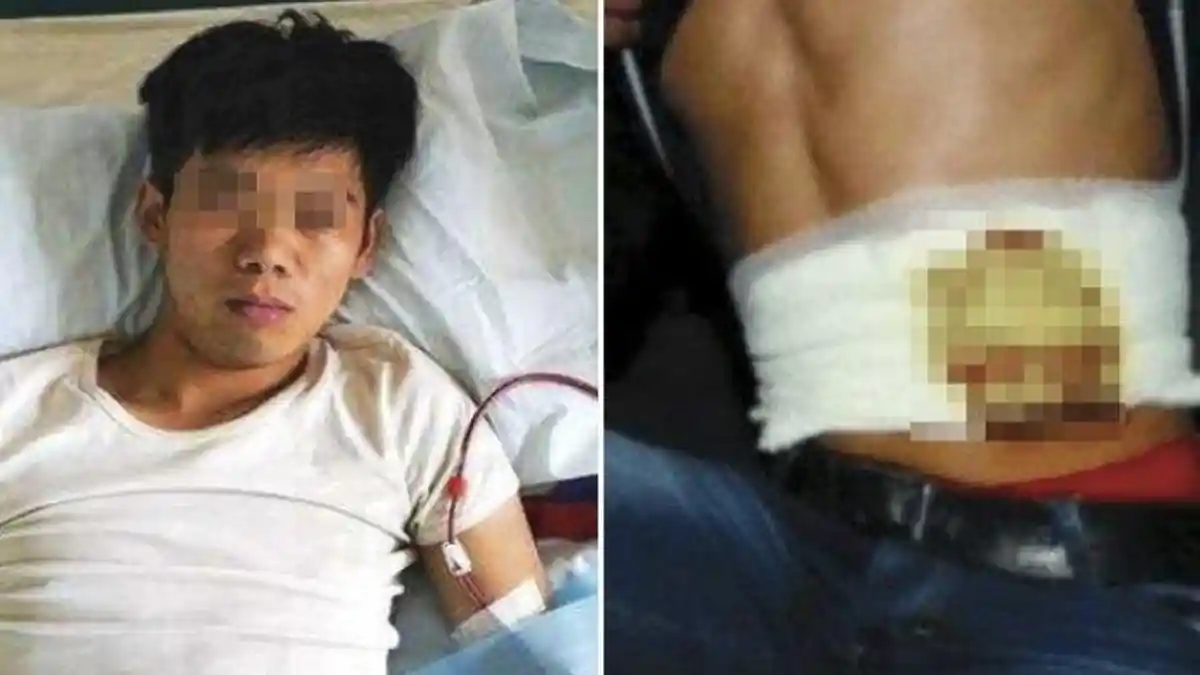 Pria Ini Rela Jual Ginjal Hanya untuk Beli iPhone 4, Begini Nasibnya Sekarang