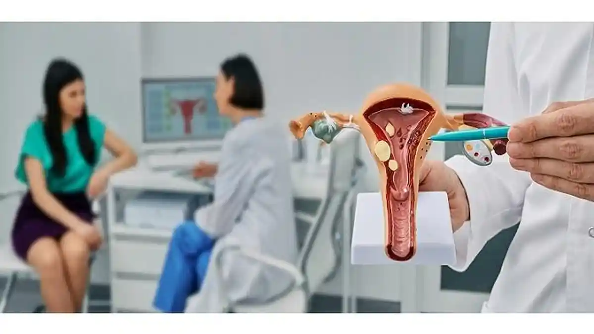 Haid Tidak Normal, Waspadai Miom dan Kista Kandungan, Ini Pejelasan Dokter