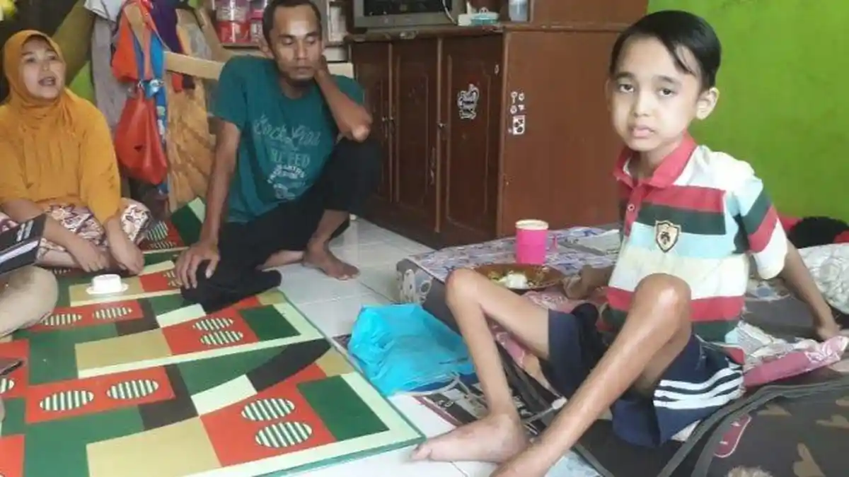 Bocah Dicimahi Ini Setahun Menderita Lumpuh dan Kakinya Mengecil, Mau Berobat Tidak Mampu
